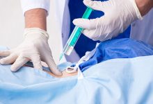 Regenerative Medicine